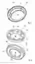 Fig. 04 - Filter device