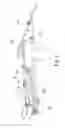 Fig. 05 - Air guiding device and aircraft engine with air guiding device