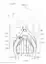 Fig. 03 - Air cleaner for motorcycle