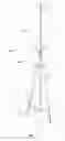 Fig. 04 - Rotor assembly for a wind turbine comprising a pair of cables