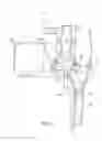 Fig. 02 - High pressure paint pump