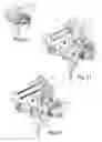 Fig. 12 - Trigger device for a semi-automatic handgun