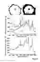 Fig. 06 - Cervical Sample Preparation For Reduced Variability In Raman Spectroscopy