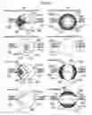 Fig. 20 - Defect detection method and defect detection device and defect observation device provided with same