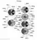 Fig. 34 - Defect detection method and defect detection device and defect observation device provided with same