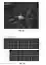 Fig. 16 - Systems, methods, and workflows for optogenetics analysis