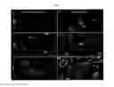 Fig. 06 - Compositions and Methods for Detection of Defensins in a Patient Sample