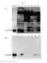 Fig. 07 - Compositions and Methods for Detection of Defensins in a Patient Sample