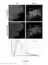Fig. 14 - METHODS FOR ANALYZING BLOOD TO DETECT DISEASES ASSOCIATED WITH ABNORMAL PROTEIN AGGREGATION