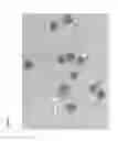 Fig. 04 - Non invasive method for prenatal diagnosis