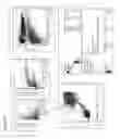 Fig. 07 - Non invasive method for prenatal diagnosis