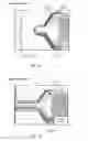 Fig. 05 - Microfluidic chip-based, universal coagulation assay