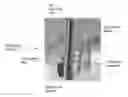 Fig. 01 - LOW CARRYOVER LIQUID HANDLING PROBE FOR AN AUTOMATED ANALYZER