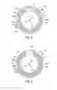 Fig. 06 - APPARATUS AND SYSTEM FOR IMAGING AN INTUBATED PATIENT
