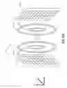 Fig. 02 - Ferromagnetic augmentation for magnetic resonance imaging