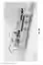 Fig. 12 - Ferromagnetic augmentation for magnetic resonance imaging
