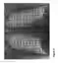 Fig. 04 - X-ray radiation detector with automatic exposure control