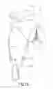 Fig. 20 - Composite wearable electronic communication device