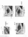 Fig. 11 - Systems, methods, and apparatus for sensitive thermal imaging