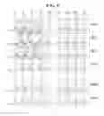 Fig. 04 - Liquid crystal display