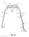 Fig. 52 - WEARABLE DEVICES INCLUDING METALIZED INTERFACES AND STRAP-INTEGRATED SENSOR ELECTRODES
