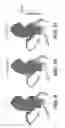 Fig. 08 - Method and system for quantifying limitations in coronary artery blood flow during physical activity in patients with coronary artery disease