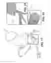Fig. 11 - Method and system for quantifying limitations in coronary artery blood flow during physical activity in patients with coronary artery disease
