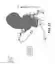Fig. 13 - Method and system for quantifying limitations in coronary artery blood flow during physical activity in patients with coronary artery disease