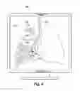 Fig. 04 - Systems and methods for pre-operative modeling