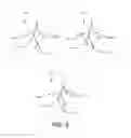 Fig. 11 - Systems and methods for pre-operative modeling