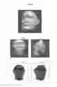 Fig. 06 - METHOD AND APPARATUS FOR FACIAL RECOGNITION