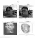 Fig. 07 - METHOD AND APPARATUS FOR FACIAL RECOGNITION
