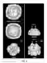 Fig. 15 - Method and system for aligning and classifying images