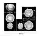 Fig. 16 - Method and system for aligning and classifying images