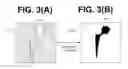 Fig. 04 - Image processing device