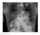 Fig. 01 - Medical image dectection system and method