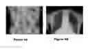 Fig. 05 - Medical image dectection system and method