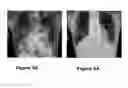 Fig. 06 - Medical image dectection system and method