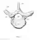 Fig. 04 - Method of obtaining and analyzing data from an upright MRI from the spinal region of a subject