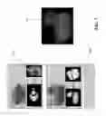 Fig. 10 - Real-Time Dynamic Three-Dimensional Adaptive Object Recognition and Model Reconstruction