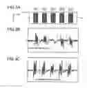 Fig. 04 - Magnetic property detection apparatus