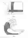 Fig. 13 - Housing features of an electronic device