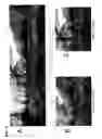 Fig. 13 - Image processing device, image processing method, and program