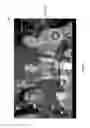 Fig. 03 - Multi-camera device