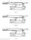 Fig. 09 - Earpiece integrated magnetic shielding for mitigating ingress of magnetic particles