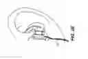 Fig. 05 - Earpiece with movable joint