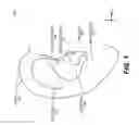 Fig. 02 - Retaining structure for an earpiece