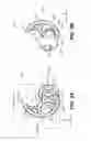 Fig. 06 - Retaining structure for an earpiece