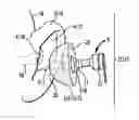 Fig. 01 - Moldable Earpiece System