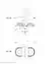 Fig. 05 - Loudspeaker with improved directional behavior and reduction of acoustical interference